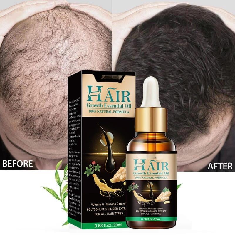 Hair growth Serum 30ml each (pack of 2)