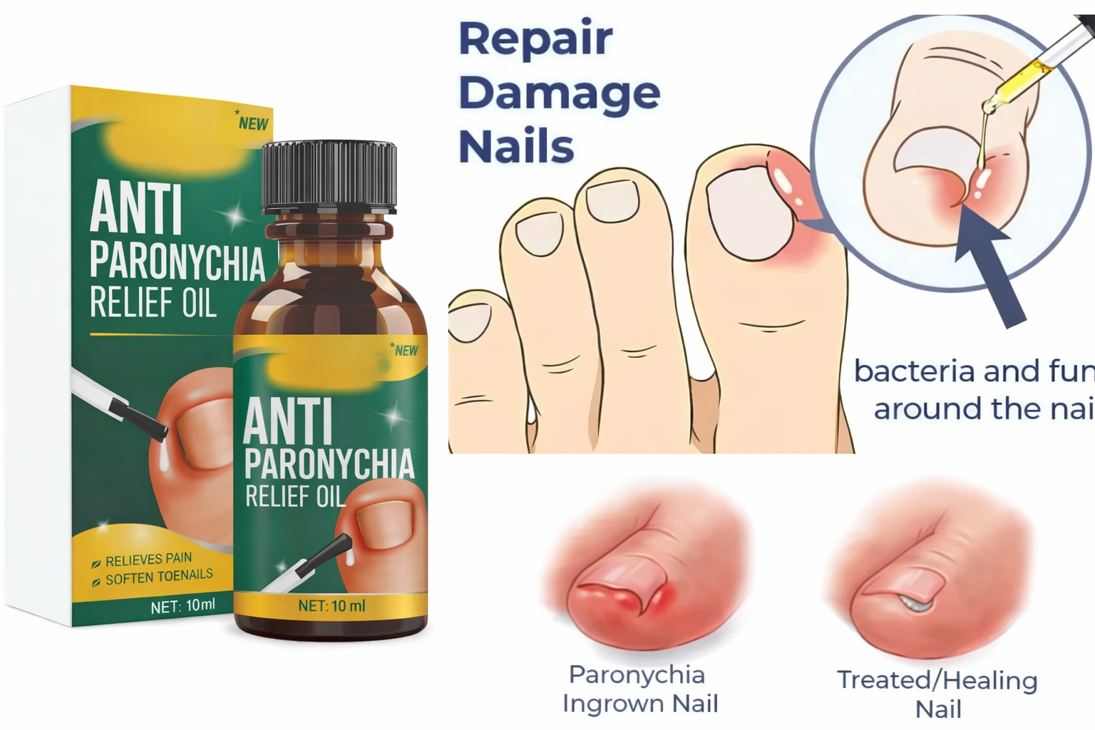 Anti Paronychia Relief Oil, 10mleach pack of 2